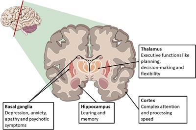 Long Term Cognitive Function After Cardiac Arrest: A Mini-Review